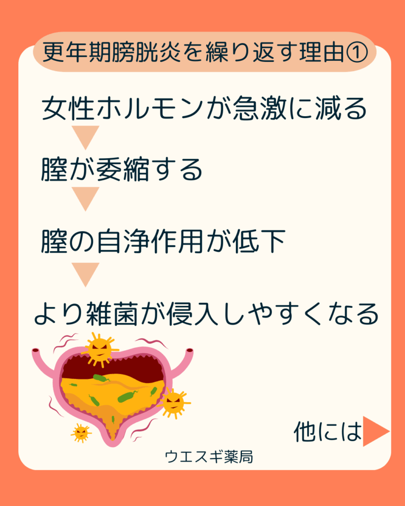 膀胱炎を繰り返すワケ