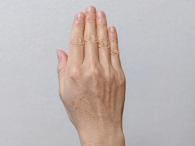 手の甲の老化