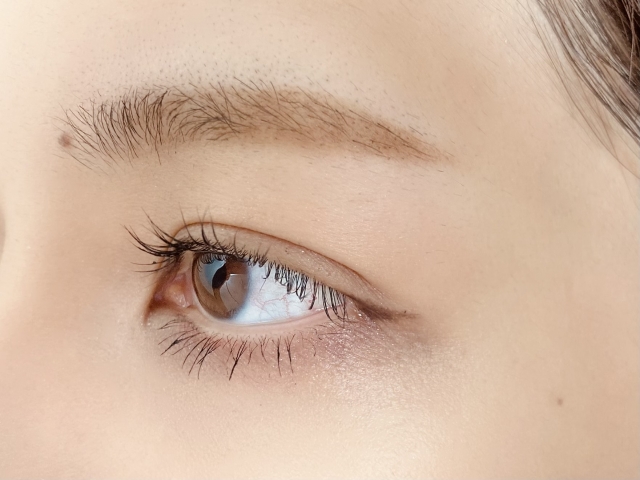 目の周りのしわ